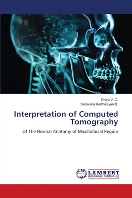 Interprétation de la tomographie assistée par ordinateur - Interpretation of Computed Tomography