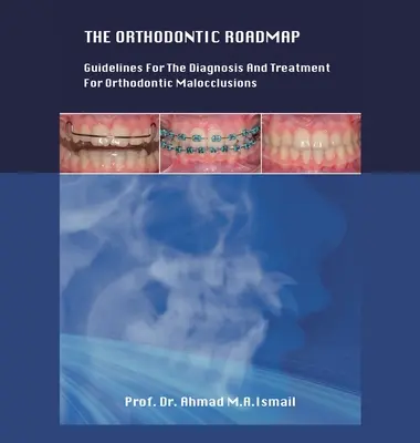 La feuille de route de l'orthodontie : Lignes directrices pour le diagnostic et le traitement des malocclusions orthodontiques - The Orthodontic Roadmap: Guidelines for the Diagnosis and Treatment of Orthodontic Malocclusions