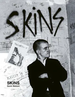 Peau : Gavin Watson Gavin Watson - Skins: Gavin Watson