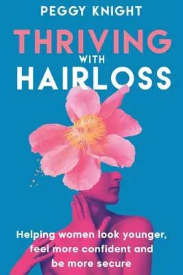 S'épanouir avec la perte de cheveux : Aider les femmes à paraître plus jeunes, à se sentir plus sûres d'elles et à être plus confiantes - Thriving With Hairloss: Helping Women Look Younger, Feel More Confident and Be More Secure