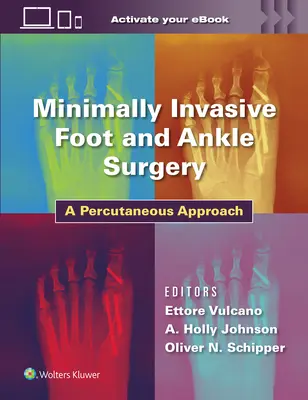 Chirurgie mini-invasive du pied et de la cheville : Une approche percutanée - Minimally Invasive Foot and Ankle Surgery: A Percutaneous Approach