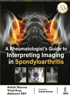 Guide d'interprétation de l'imagerie de la spondylarthrite à l'usage des rhumatologues - Rheumatologist's Guide to Interpreting Imaging in Spondyloarthritis