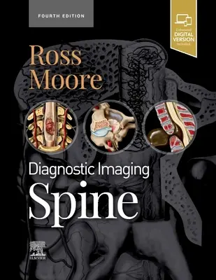 Imagerie diagnostique : Spine (Ross Jeffrey S. (Professeur de radiologie Mayo Clinic College Rochester Minnesota)) - Diagnostic Imaging: Spine (Ross Jeffrey S. (Professor of Radiology Mayo Clinic College Rochester Minnesota))