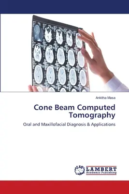 Tomographie assistée par ordinateur à faisceau conique - Cone Beam Computed Tomography