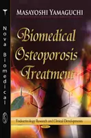 Traitement biomédical de l'ostéoporose - Nouveau développement avec des facteurs alimentaires fonctionnels - Biomedical Osteoporosis Treatment - New Development with Functional Food Factors