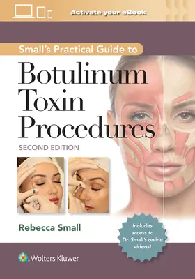 Guide pratique des interventions à la toxine botulique (Small) - Small's Practical Guide to Botulinum Toxin Procedures