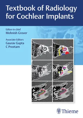 Manuel de radiologie pour les implants cochléaires - Textbook of Radiology for Cochlear Implants