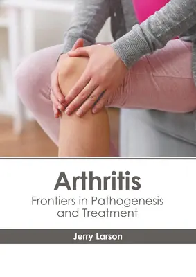 Arthrite : Frontières de la pathogenèse et du traitement - Arthritis: Frontiers in Pathogenesis and Treatment