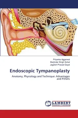 Tympanoplastie endoscopique - Endoscopic Tympanoplasty