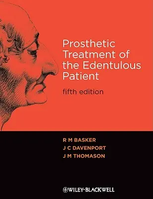 Traitement prothétique 5e - Prosthetic Treatment 5e