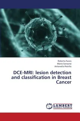 Dce-MRI : Détection et classification des lésions dans le cancer du sein - Dce-MRI: Lesion Detection and Classification in Breast Cancer