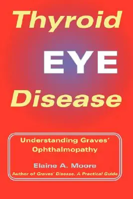Maladie oculaire thyroïdienne : Comprendre l'ophtalmopathie de Graves - Thyroid Eye Disease: Understanding Graves' Ophthalmopathy