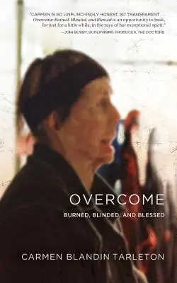 Vaincre : Brûlés, aveuglés et bénis - Overcome: Burned, Blinded, and Blessed