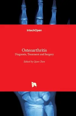 L'arthrose : Diagnostic, traitement et chirurgie - Osteoarthritis: Diagnosis, Treatment and Surgery