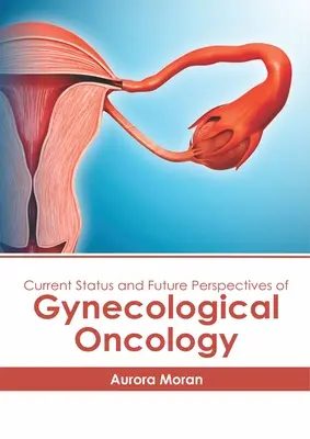 Situation actuelle et perspectives d'avenir de l'oncologie gynécologique - Current Status and Future Perspectives of Gynecological Oncology