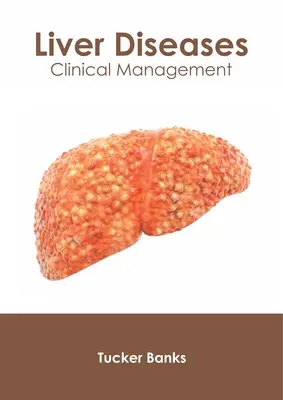 Maladies du foie : Gestion clinique - Liver Diseases: Clinical Management