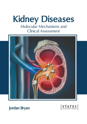 Maladies rénales : Mécanismes moléculaires et évaluation clinique - Kidney Diseases: Molecular Mechanisms and Clinical Assessment