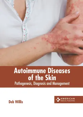 Maladies auto-immunes de la peau : Pathogenèse, diagnostic et prise en charge - Autoimmune Diseases of the Skin: Pathogenesis, Diagnosis and Management
