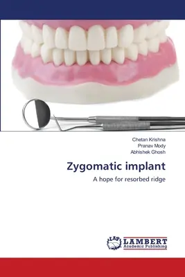 Implant zygomatique - Zygomatic implant
