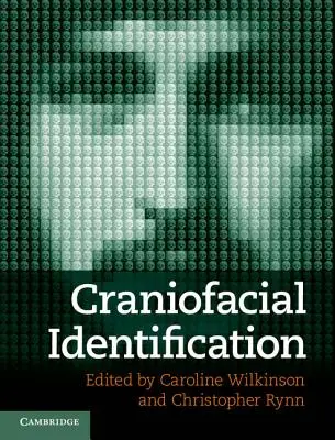 Identification craniofaciale - Craniofacial Identification