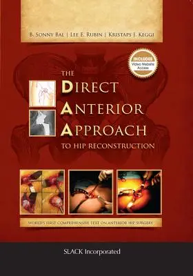 L'approche antérieure directe de la reconstruction de la hanche - The Direct Anterior Approach to Hip Reconstruction