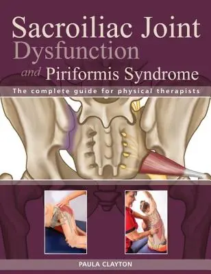 Dysfonctionnement de l'articulation sacro-iliaque et syndrome du piriforme : Le guide complet pour les physiothérapeutes - Sacroiliac Joint Dysfunction and Piriformis Syndrome: The Complete Guide for Physical Therapists