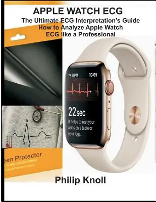 ECG de l'Apple Watch : Le guide ultime d'interprétation de l'ECG ; Comment analyser l'ECG de l'Apple Watch comme un professionnel - Apple Watch ECG: The Ultimate ECG Interpretation Guide; How to Analyze Apple Watch ECG Like a Professional