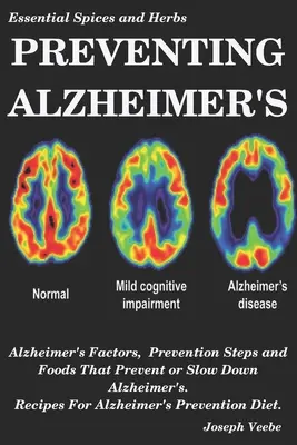 Prévenir la maladie d'Alzheimer : Les facteurs de la maladie d'Alzheimer, les mesures de prévention et les aliments qui préviennent ou ralentissent la maladie d'Alzheimer, Recettes pour la prévention de la maladie d'Alzheimer D - Preventing Alzheimer's: Alzheimer's Factors, Prevention Steps and Foods That Prevent or Slow Alzheimer's, Recipes for Alzheimer's Prevention D