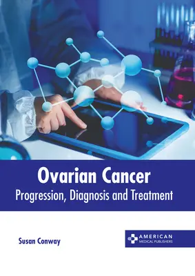 Cancer de l'ovaire : Progression, diagnostic et traitement - Ovarian Cancer: Progression, Diagnosis and Treatment