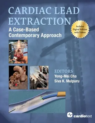 Extraction des sondes cardiaques : Une approche contemporaine basée sur des cas concrets - Cardiac Lead Extraction: A Case-Based Contemporary Approach