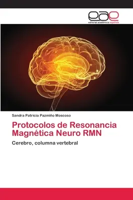 Protocolos de Resonancia Magntica Neuro RMN (en anglais) - Protocolos de Resonancia Magntica Neuro RMN