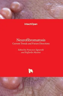 La neurofibromatose : Tendances actuelles et orientations futures - Neurofibromatosis: Current Trends and Future Directions