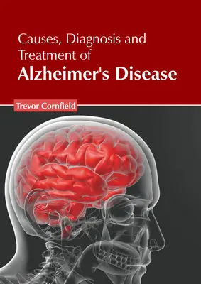 Causes, diagnostic et traitement de la maladie d'Alzheimer - Causes, Diagnosis and Treatment of Alzheimer's Disease