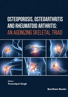 Ostéoporose, arthrose et polyarthrite rhumatoïde : Une triade squelettique éprouvante - Osteoporosis, Osteoarthritis and Rheumatoid Arthritis: An Agonizing Skeletal Triad