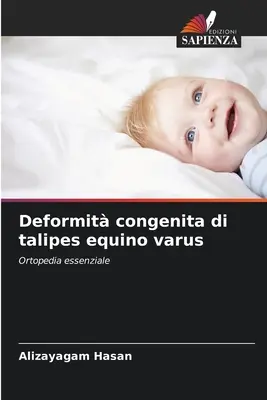 Deformit congenita di talipes equino varus