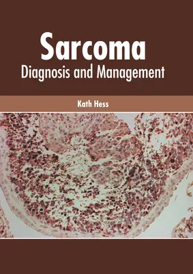 Sarcome : Diagnostic et gestion - Sarcoma: Diagnosis and Management