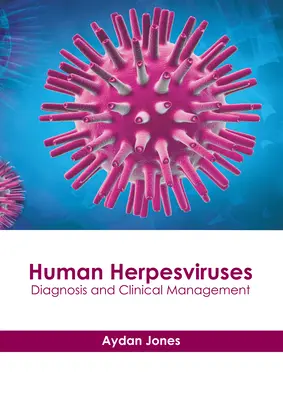 Herpèsvirus humains : Diagnostic et prise en charge clinique - Human Herpesviruses: Diagnosis and Clinical Management