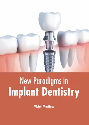 Nouveaux paradigmes en dentisterie implantaire - New Paradigms in Implant Dentistry