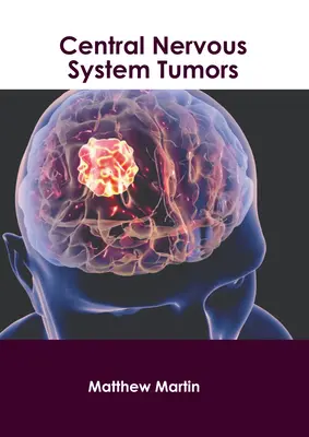 Tumeurs du système nerveux central - Central Nervous System Tumors