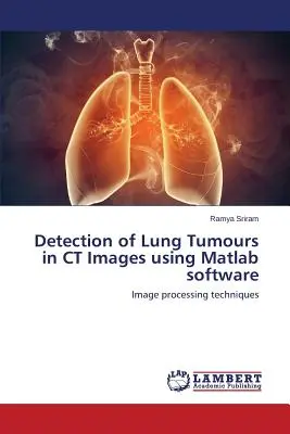 Détection des tumeurs pulmonaires dans les images de tomodensitométrie à l'aide du logiciel Matlab - Detection of Lung Tumours in CT Images using Matlab software