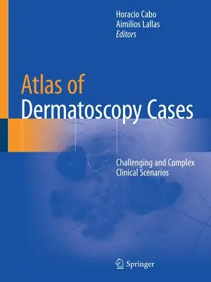 Atlas des cas de dermatoscopie : Scénarios cliniques difficiles et complexes - Atlas of Dermatoscopy Cases: Challenging and Complex Clinical Scenarios