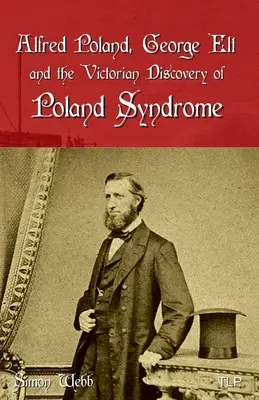 Alfred Poland, George Elt et la découverte victorienne du syndrome de Poland - Alfred Poland, George Elt and the Victorian Discovery of Poland Syndrome