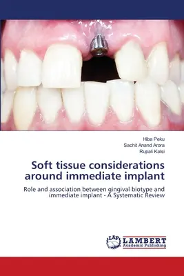 Considérations sur les tissus mous autour de l'implant immédiat - Soft tissue considerations around immediate implant
