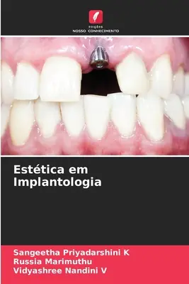 Estetica em Implantologia (en anglais) - Esttica em Implantologia