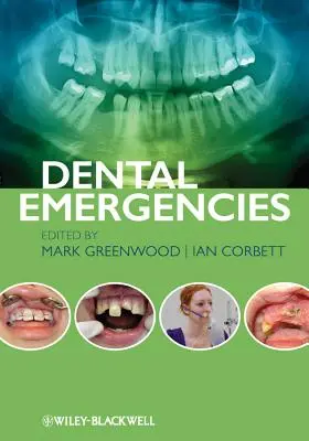 Urgences dentaires - Dental Emergencies