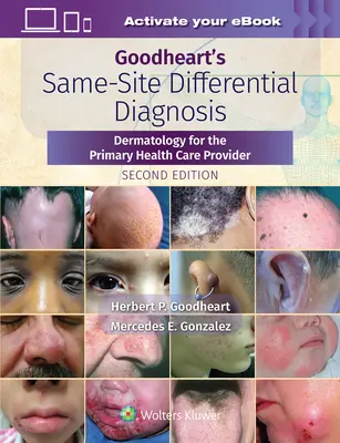Goodheart's Same-Site Differential Diagnosis : Dermatologie pour le prestataire de soins de santé primaires - Goodheart's Same-Site Differential Diagnosis: Dermatology for the Primary Health Care Provider