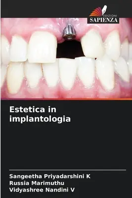 Esthétique en implantologie - Estetica in implantologia