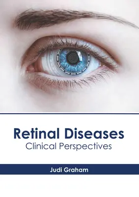 Maladies de la rétine : Perspectives cliniques - Retinal Diseases: Clinical Perspectives