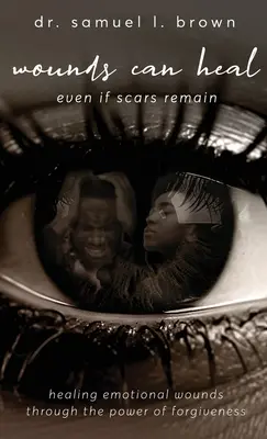 Les blessures peuvent guérir, guérir les blessures émotionnelles par le pouvoir du pardon - Wounds Can Heal, Healing Emotional Wounds Through the Power of Forgiveness