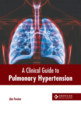 Guide clinique de l'hypertension pulmonaire - A Clinical Guide to Pulmonary Hypertension